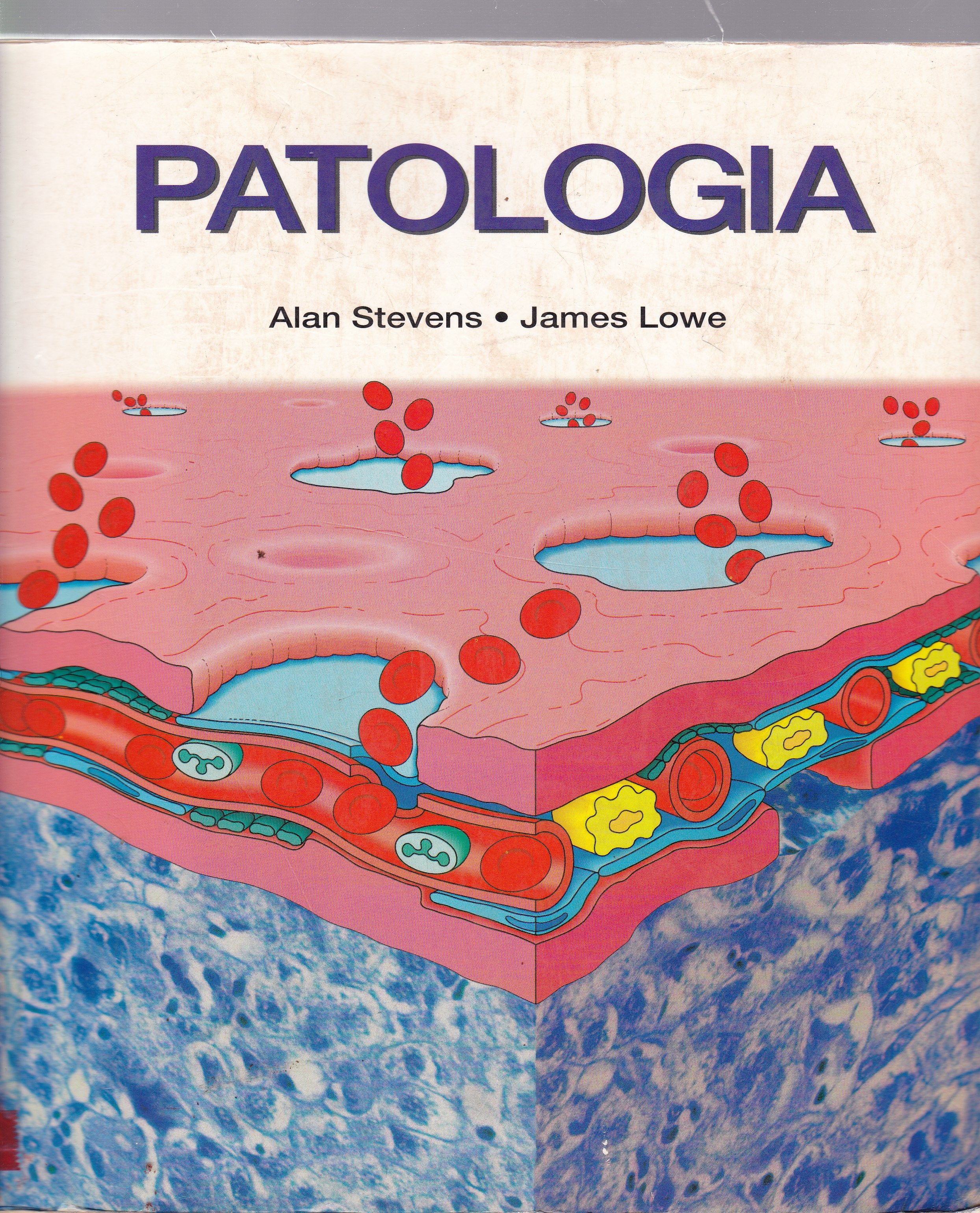 PATOLOGIA