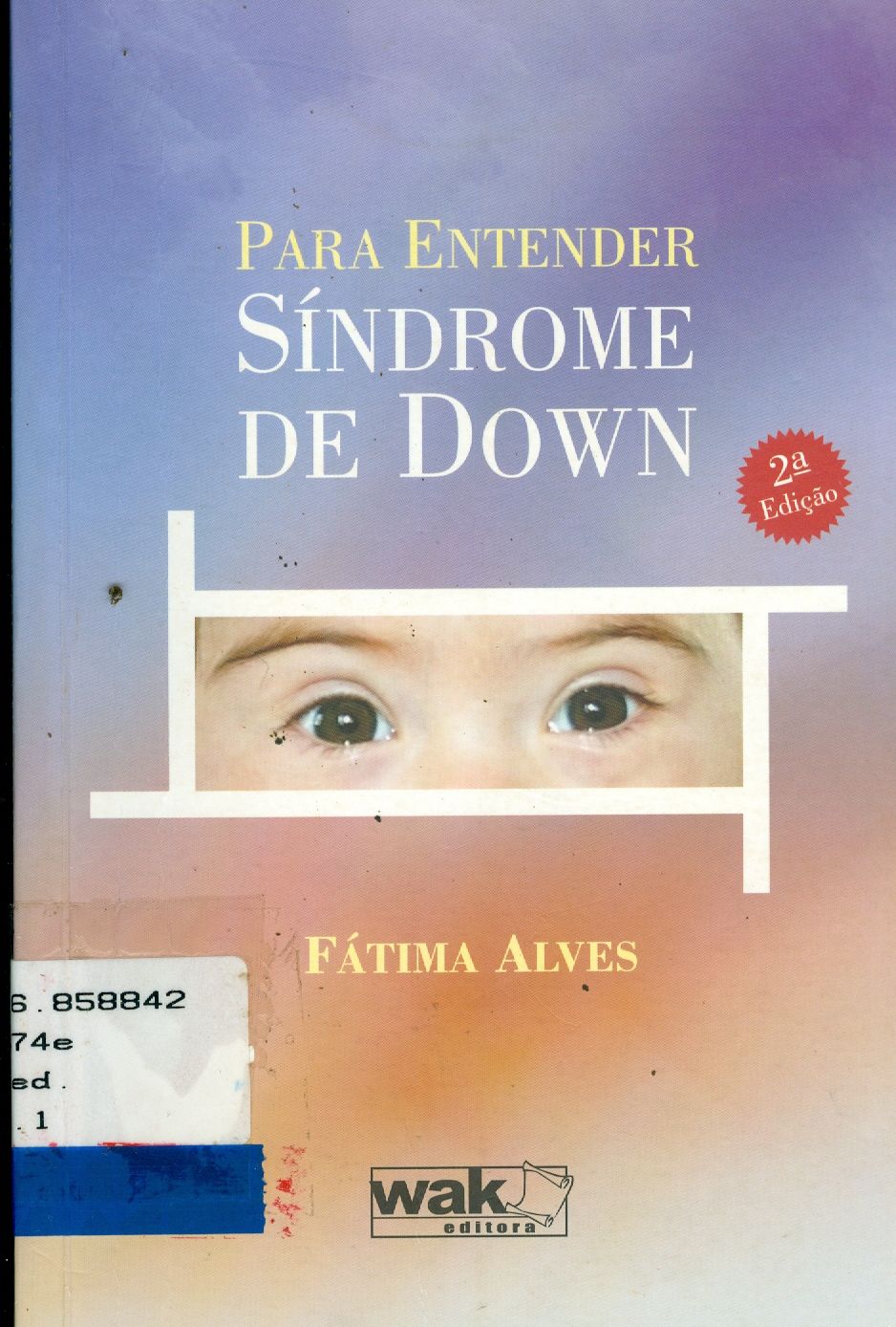 PARA ENTENDER SÍNDROME DE DOWN