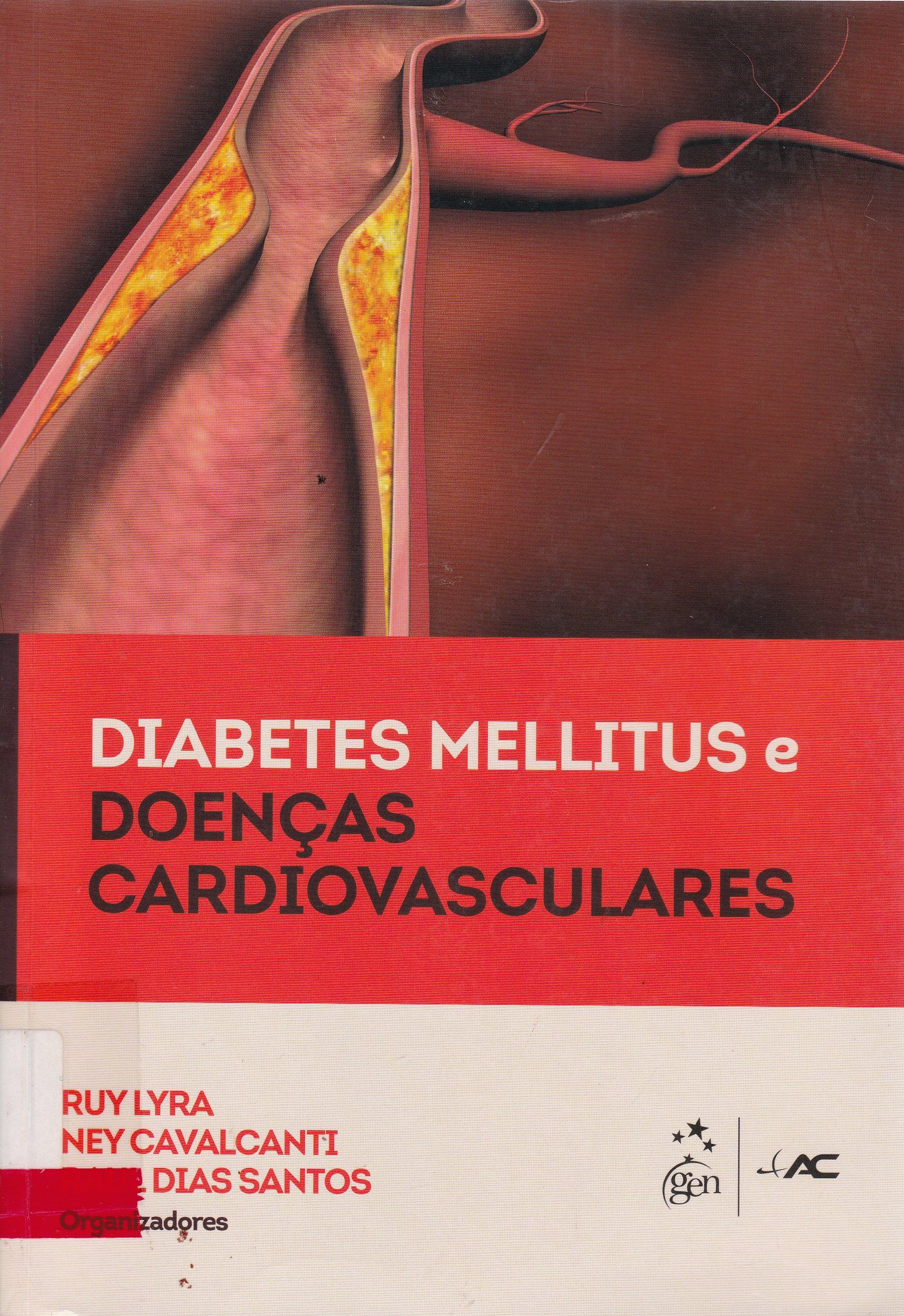 DIABETES MELLITUS E DOENÇAS CARDIOVASCULARES