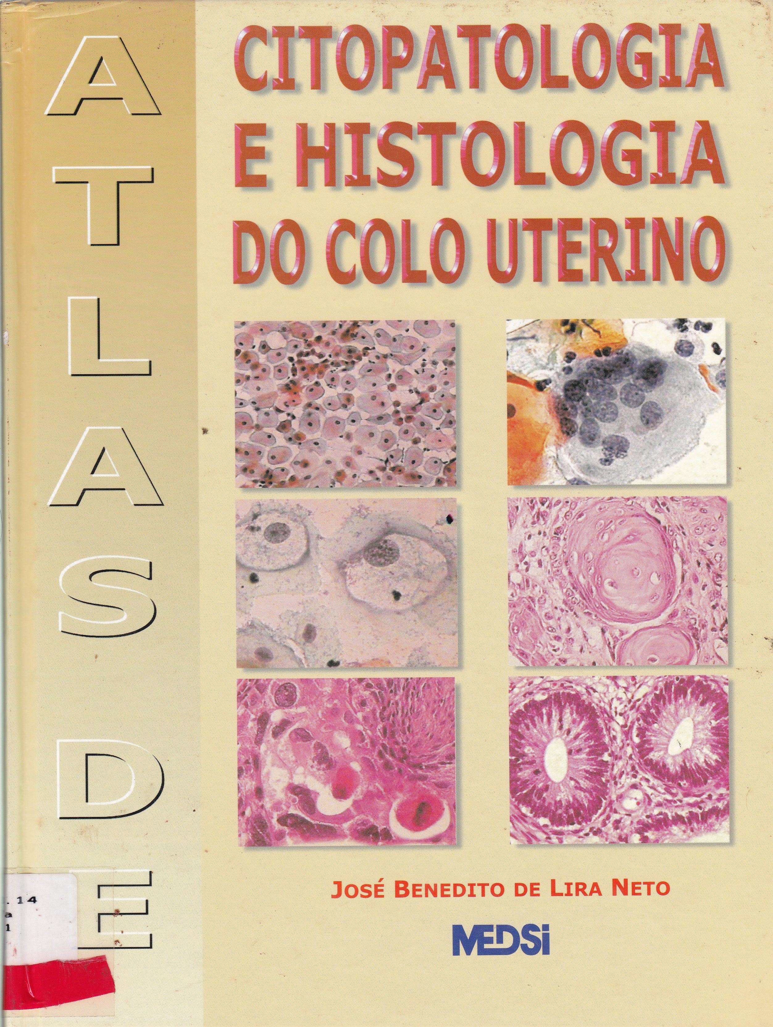 ATLAS DE CITOPATOLOGIA E HISTOLOGIA DO CÓLO UTERINO