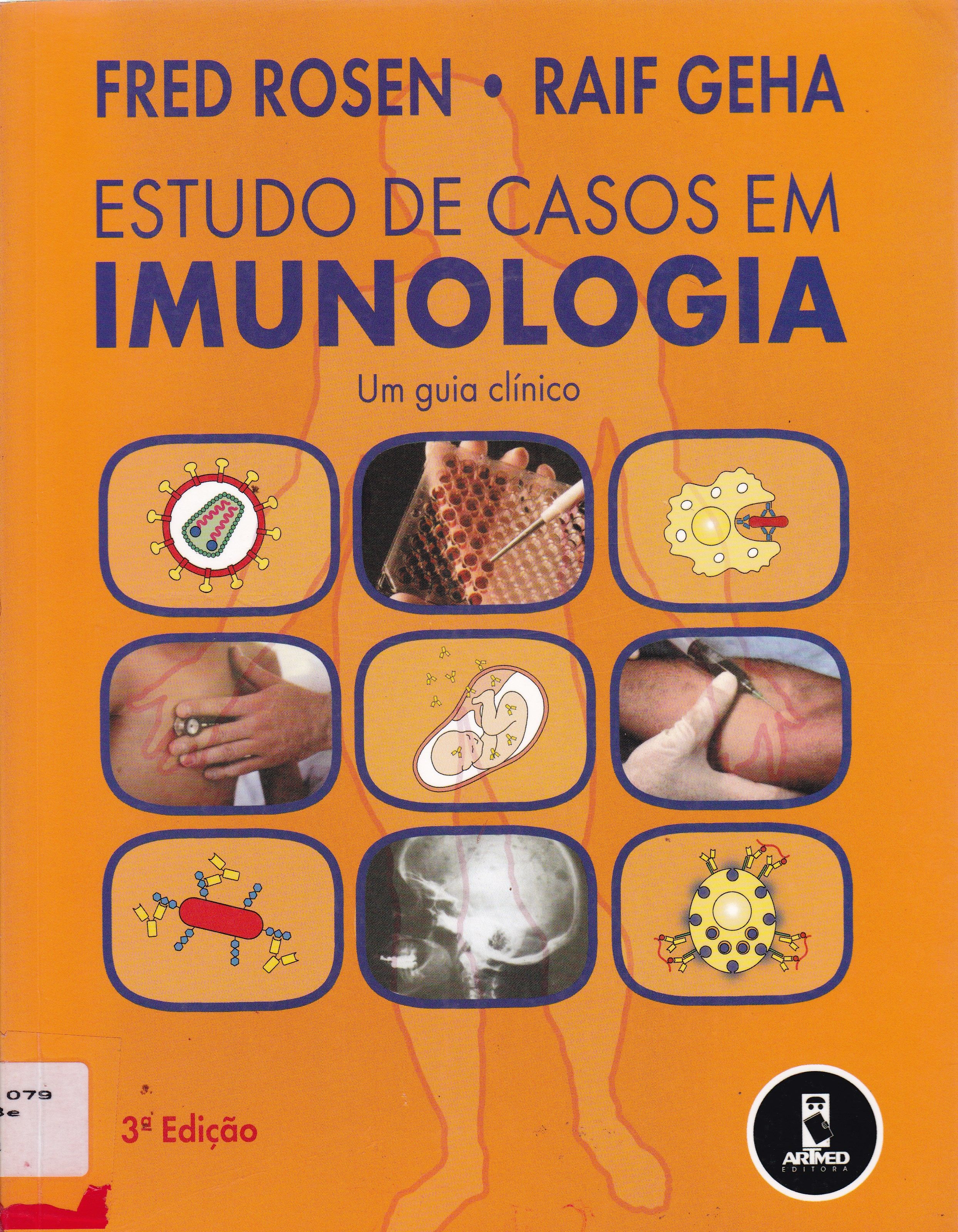 ESTUDO DE CASOS EM IMUNOLOGIA: UM GUIA CLÍNICO