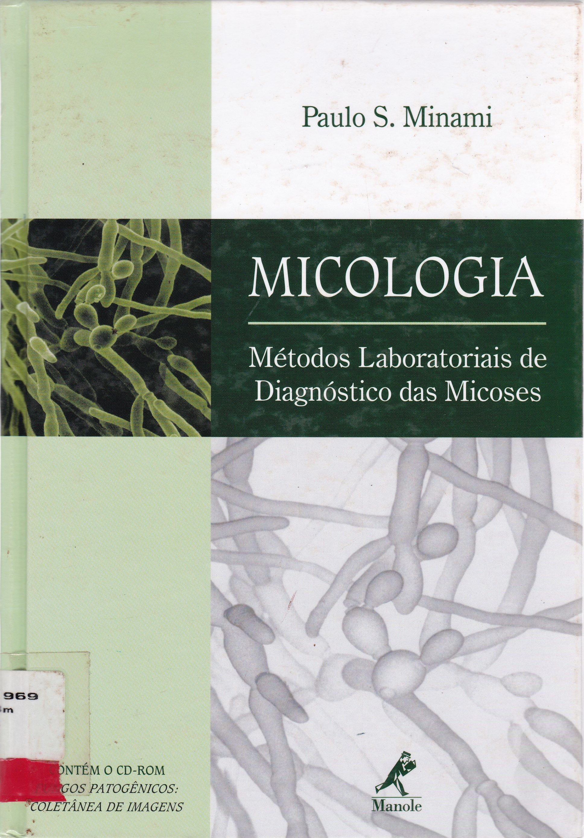 MICOLOGIA: MÉTODOS LABORATORIAIS DE DIAGNÓSTICO DAS MICOSES