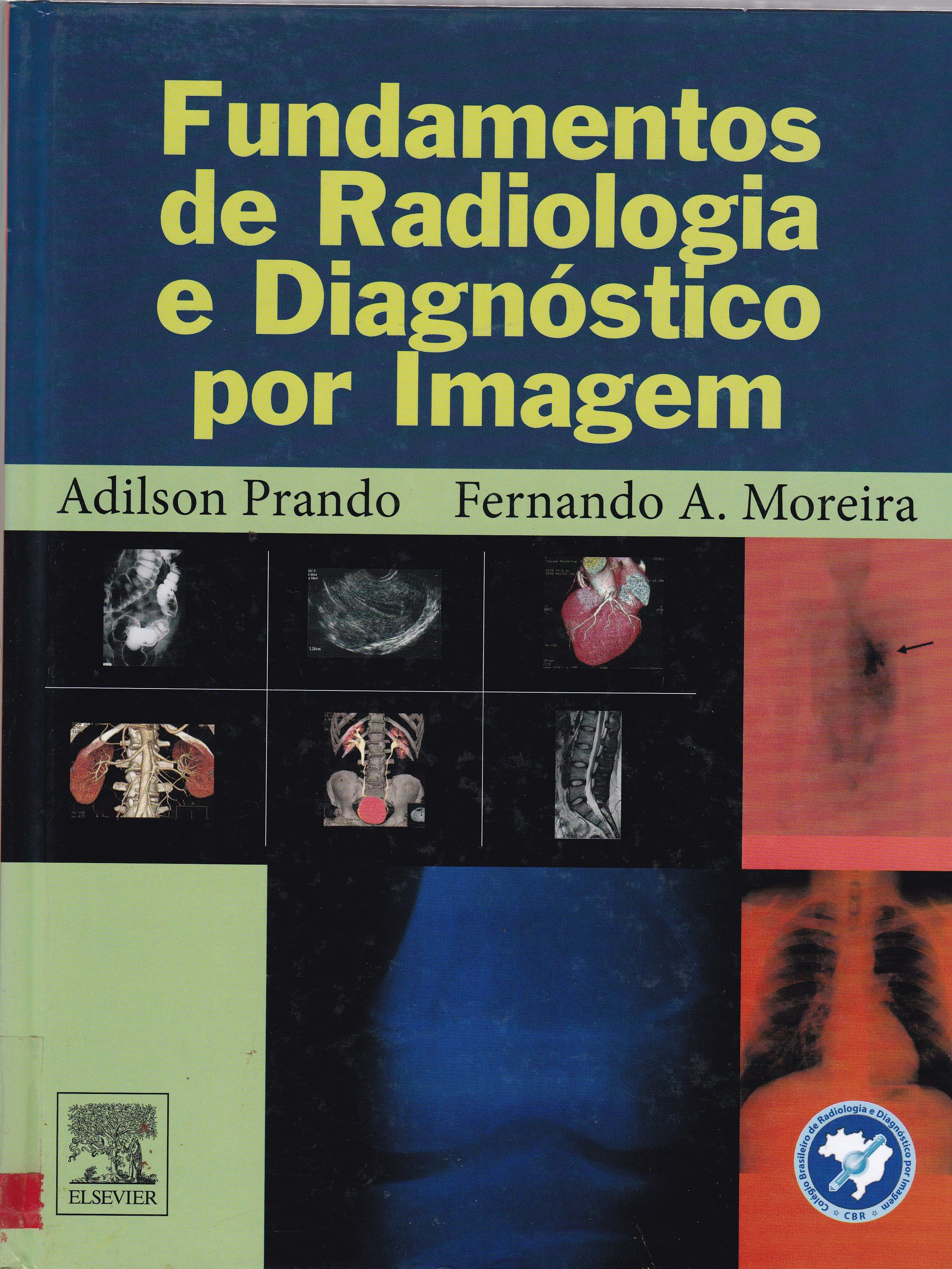 FUNDAMENTOS DE RADIOLOGIA E DIAGNÓSTICO POR IMAGEM