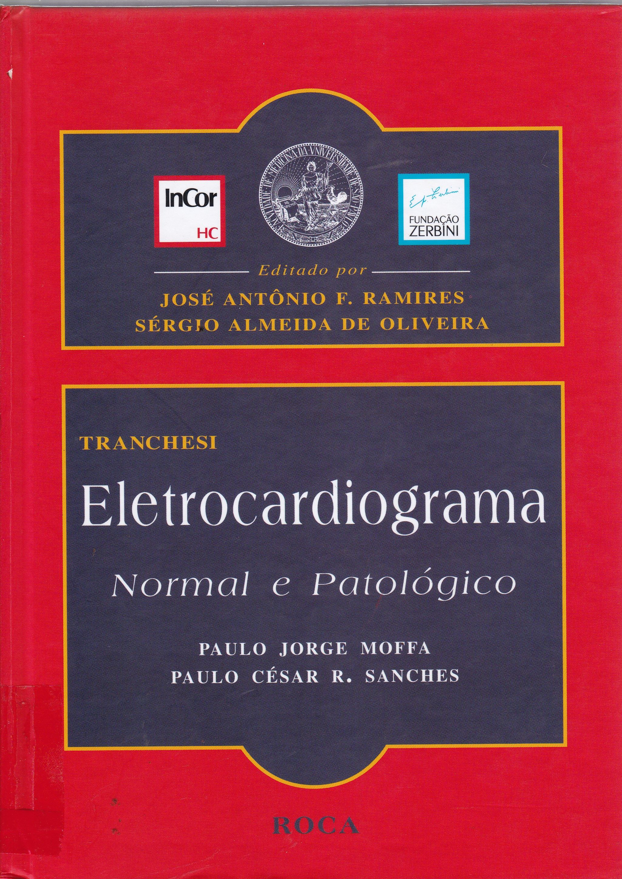 ELETROCARDIOGRAMA: NORMAL E PATOLÓGICO