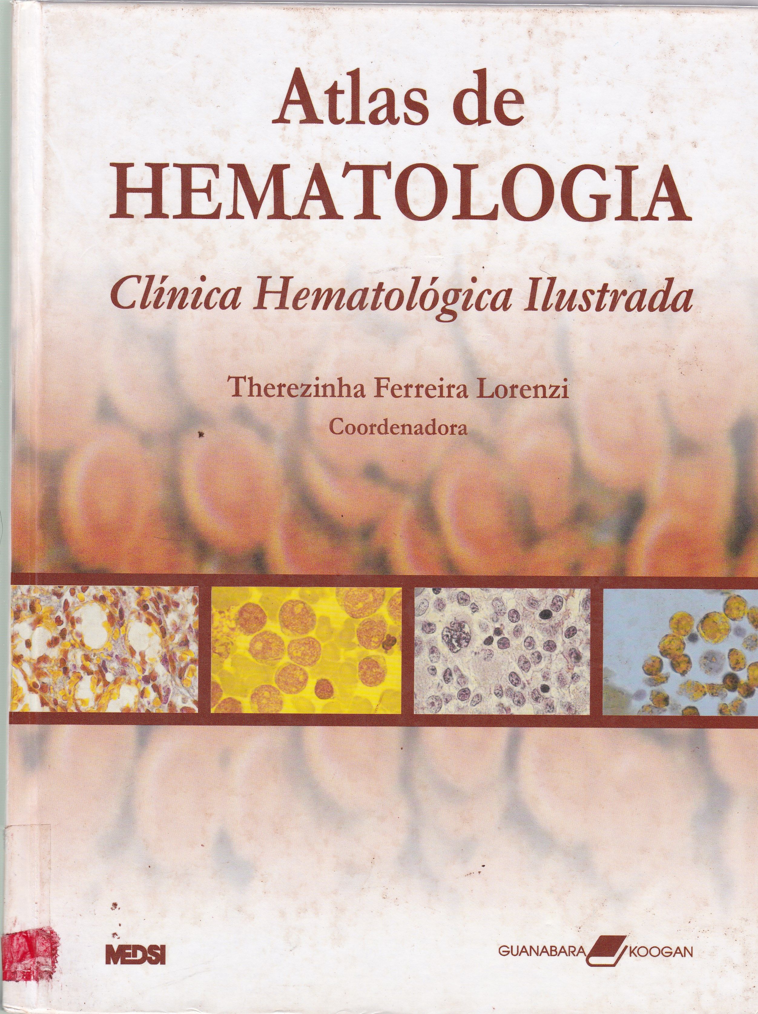 ATLÂS DE HEMATOLOGIA: CLÍNICA HEMATOLÓGICA ILUSTRADA