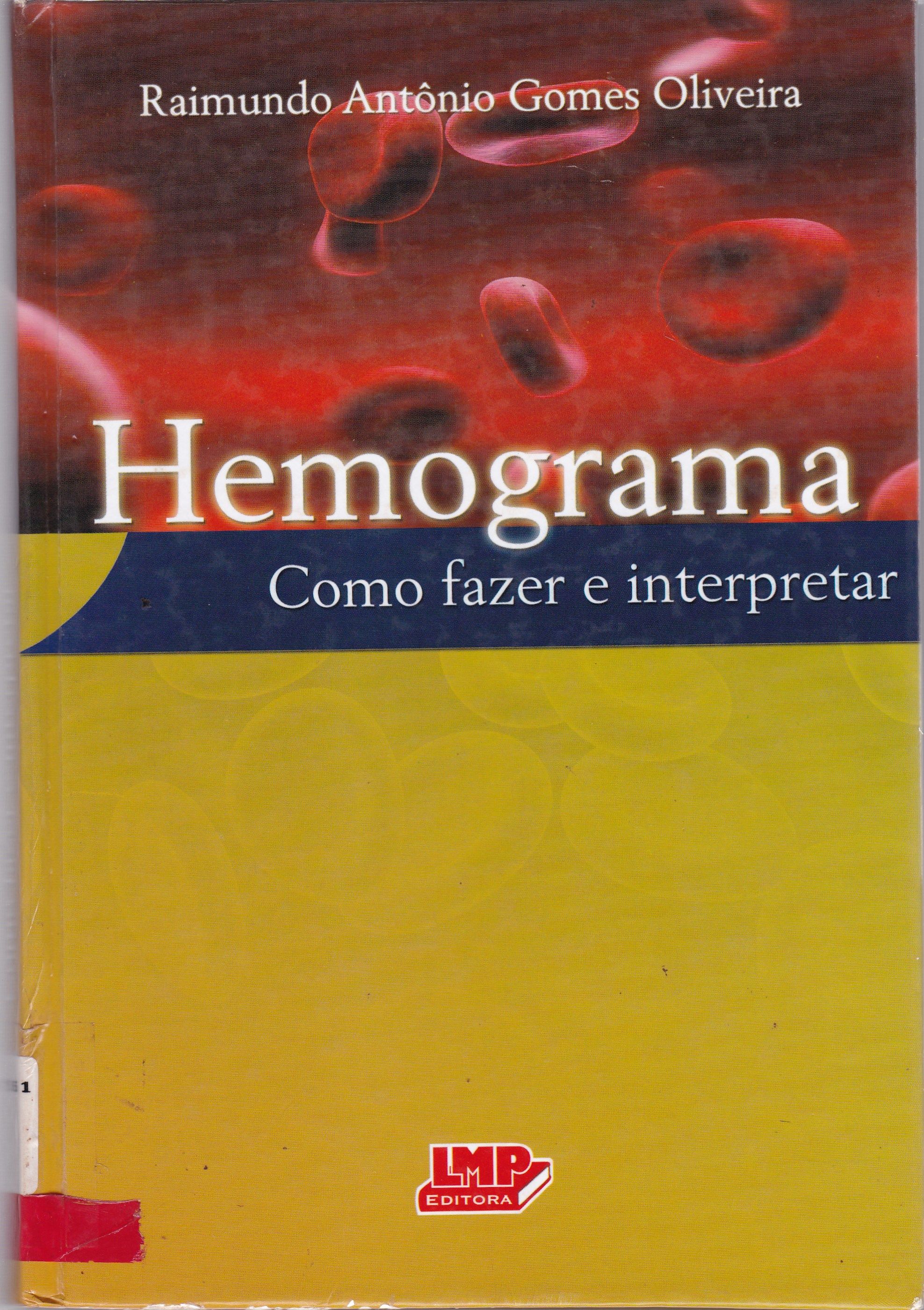 HEMOGRAMA: COMO FAZER E INTERPRETAR