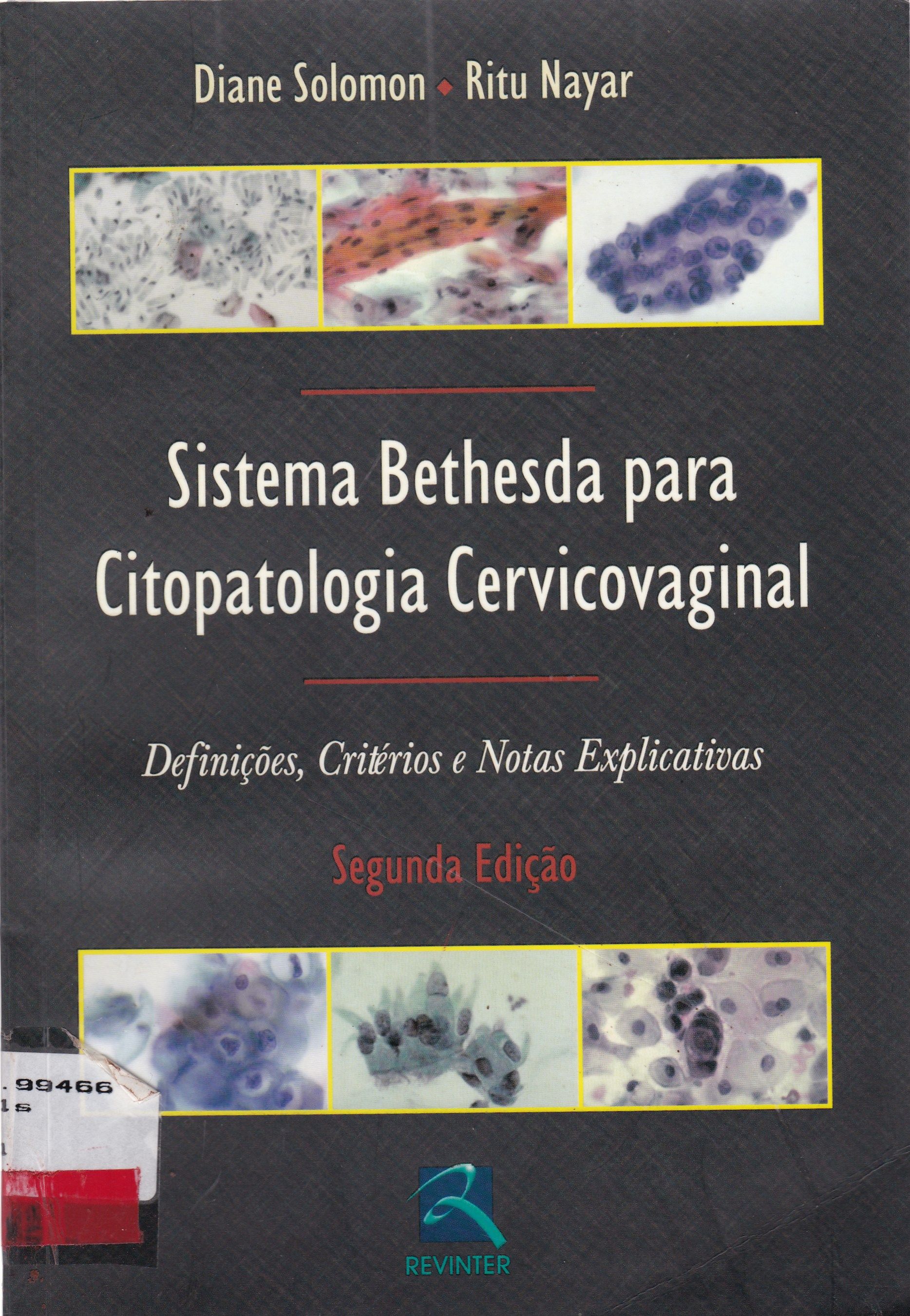 SISTEMA BETHESDA PARA CITOPATOLOGIA CERVICOVAGINAL: DEFINIÇÕES, CRITÉRIOS E NOTAS EXPLICATIVAS