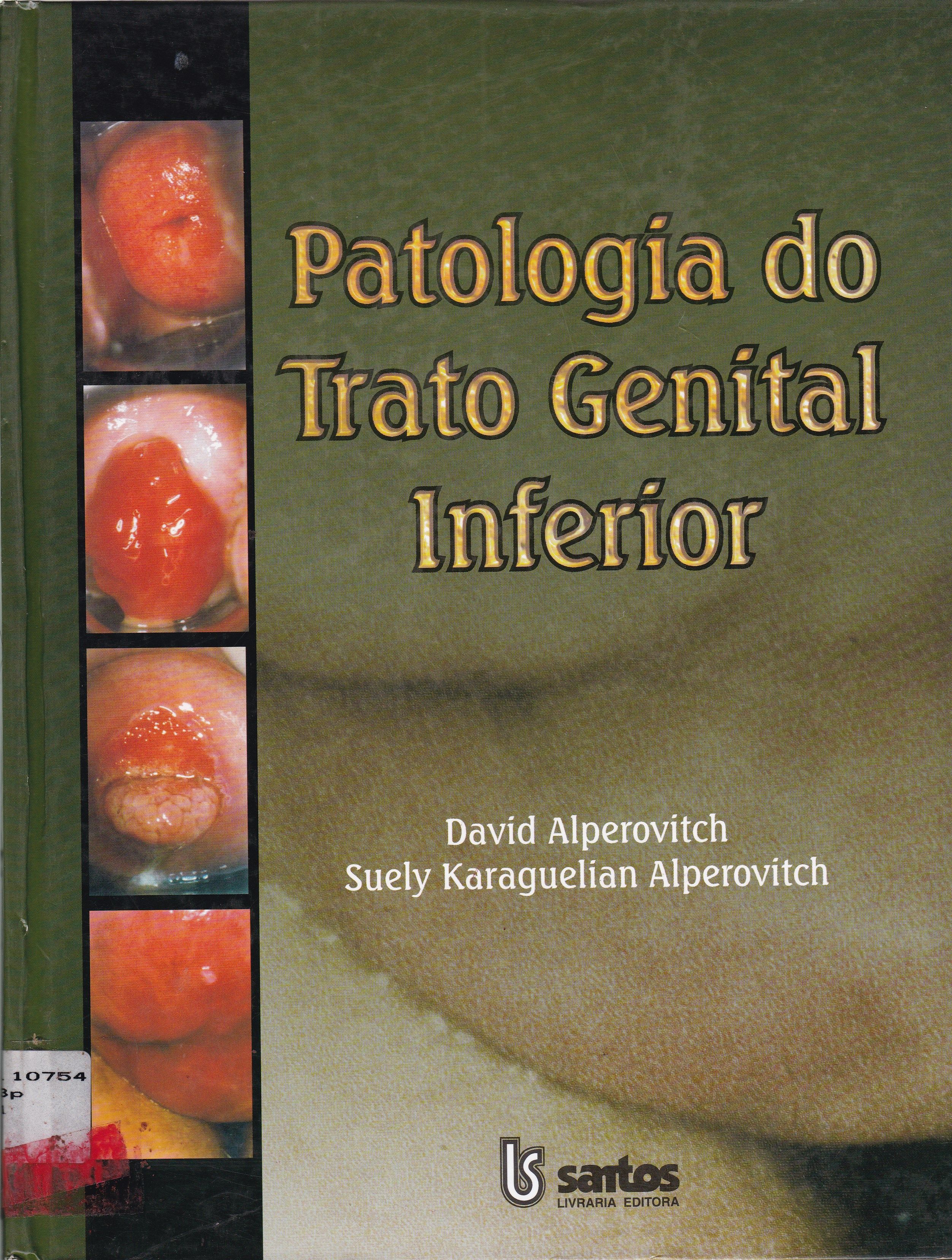PATOLOGIA DO TRATO GENITAL INFERIOR