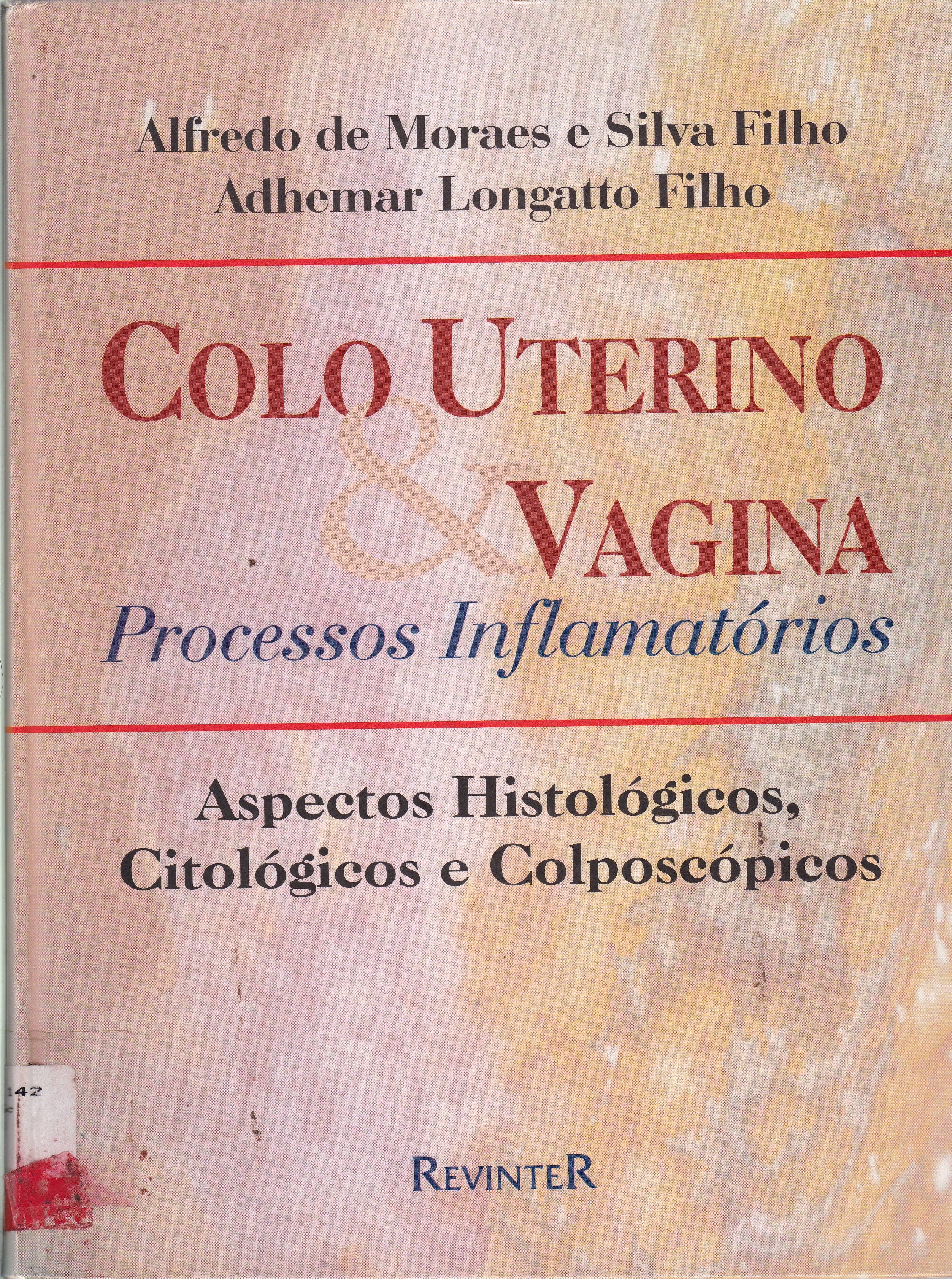 COLO UTERINO E VAGINA: PROCESSO INFLAMATÓRIOS: ASPECTOS HISTOLÓGICOS, CITOLÓGICOS E COLPOSCÓPICOS