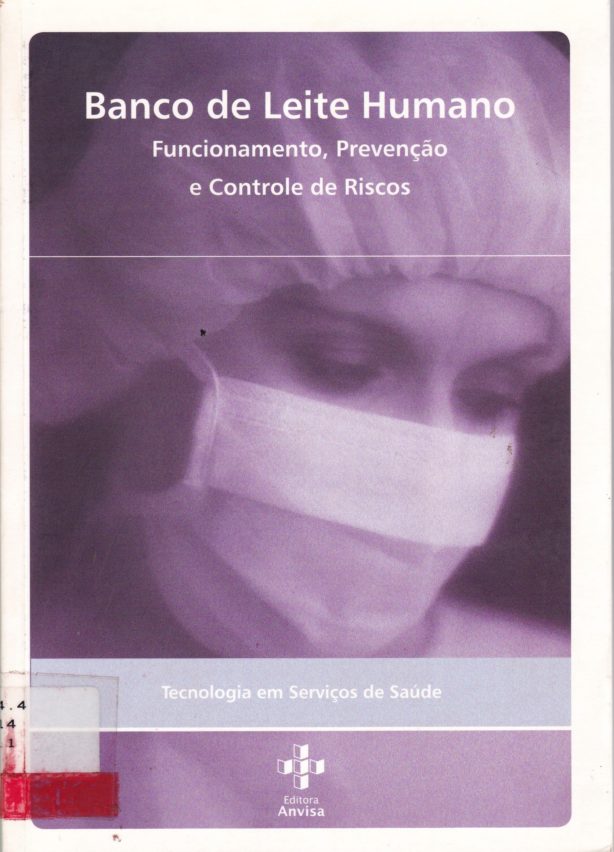 BANCO DE LEITE HUMANO: FUNCIONAMENTO, PREVENÇÃO E CONTROLE DE RISCOS