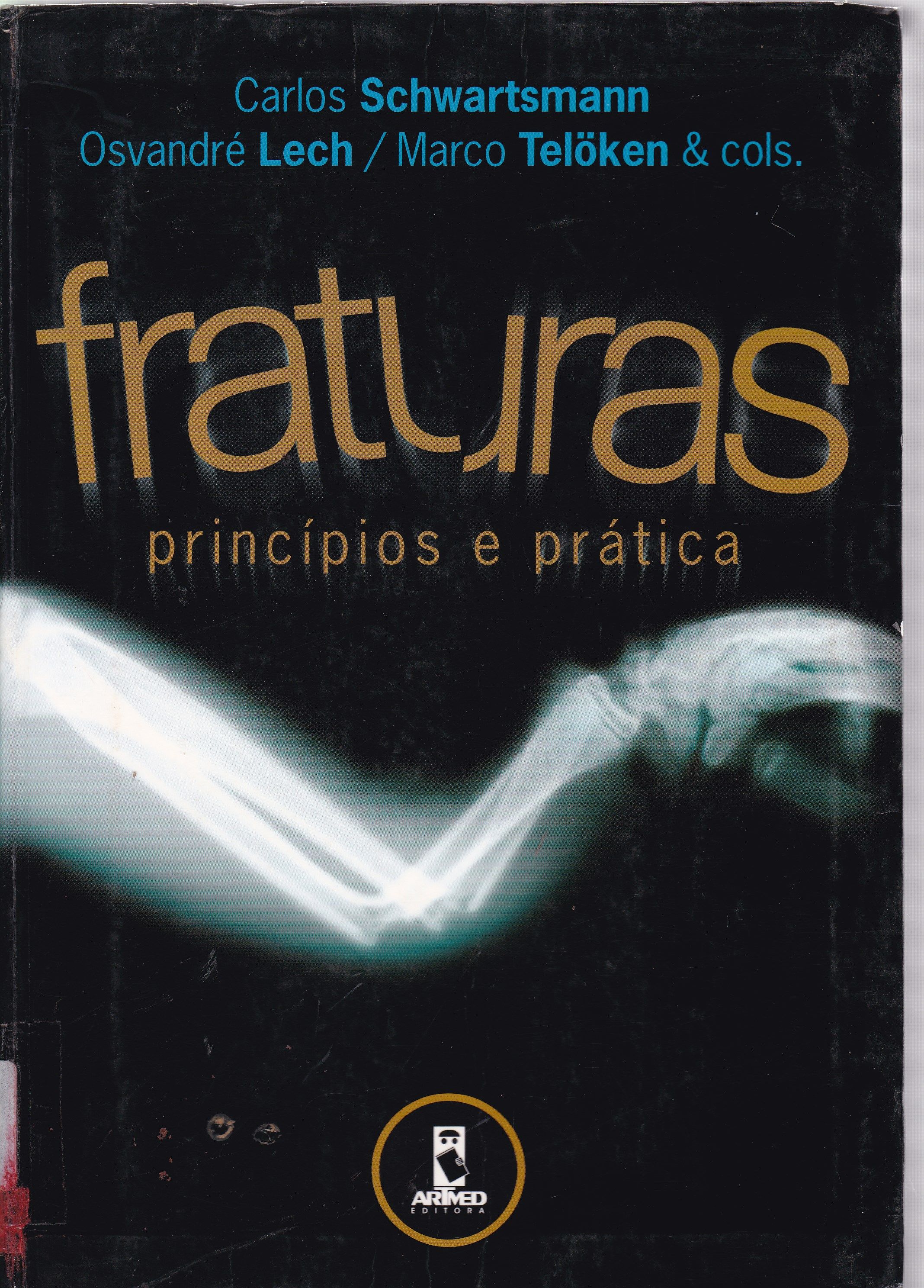 FRATURAS