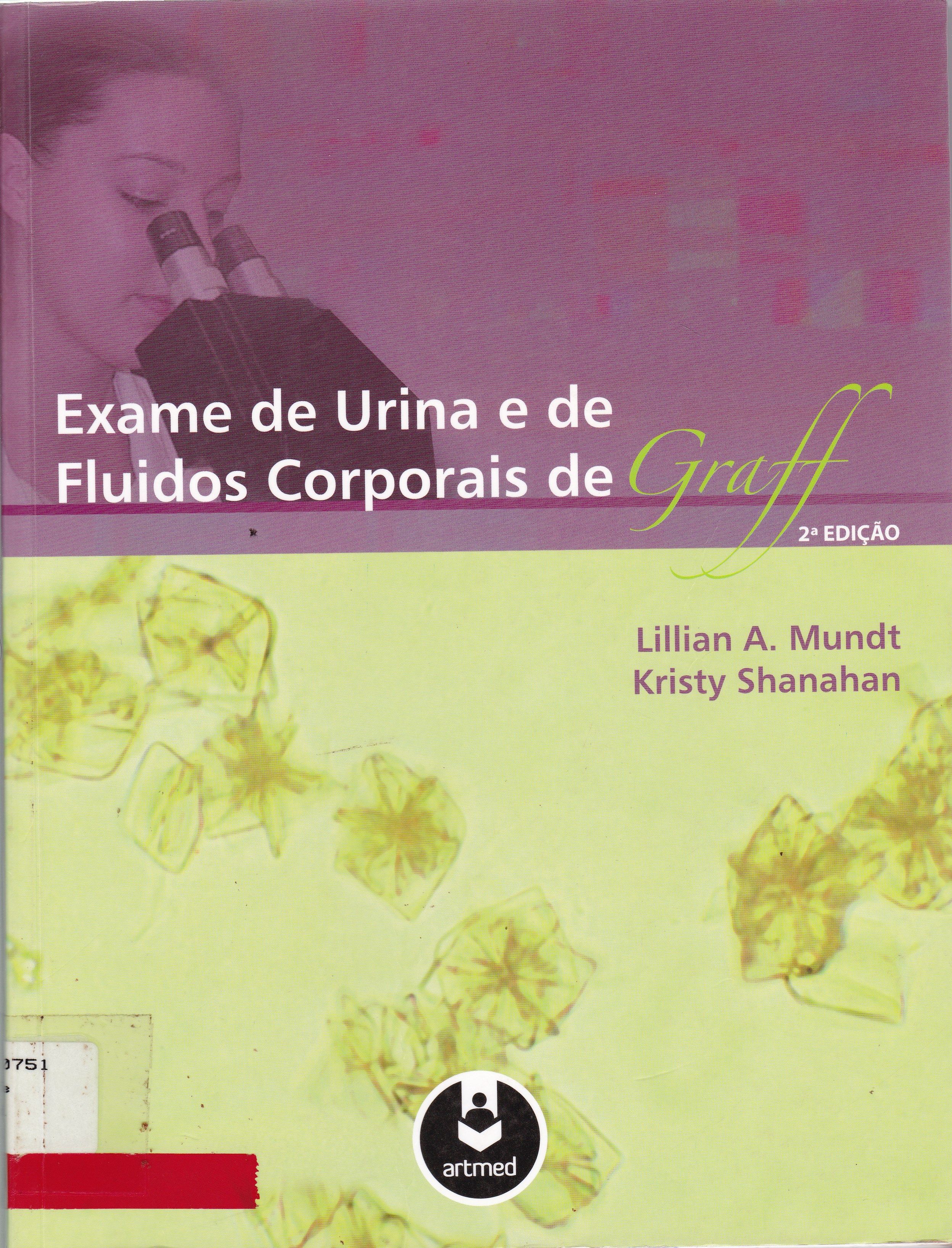 EXAME DE URINA E DE FLUÍDOS CORPORAIS DE GRAFF
