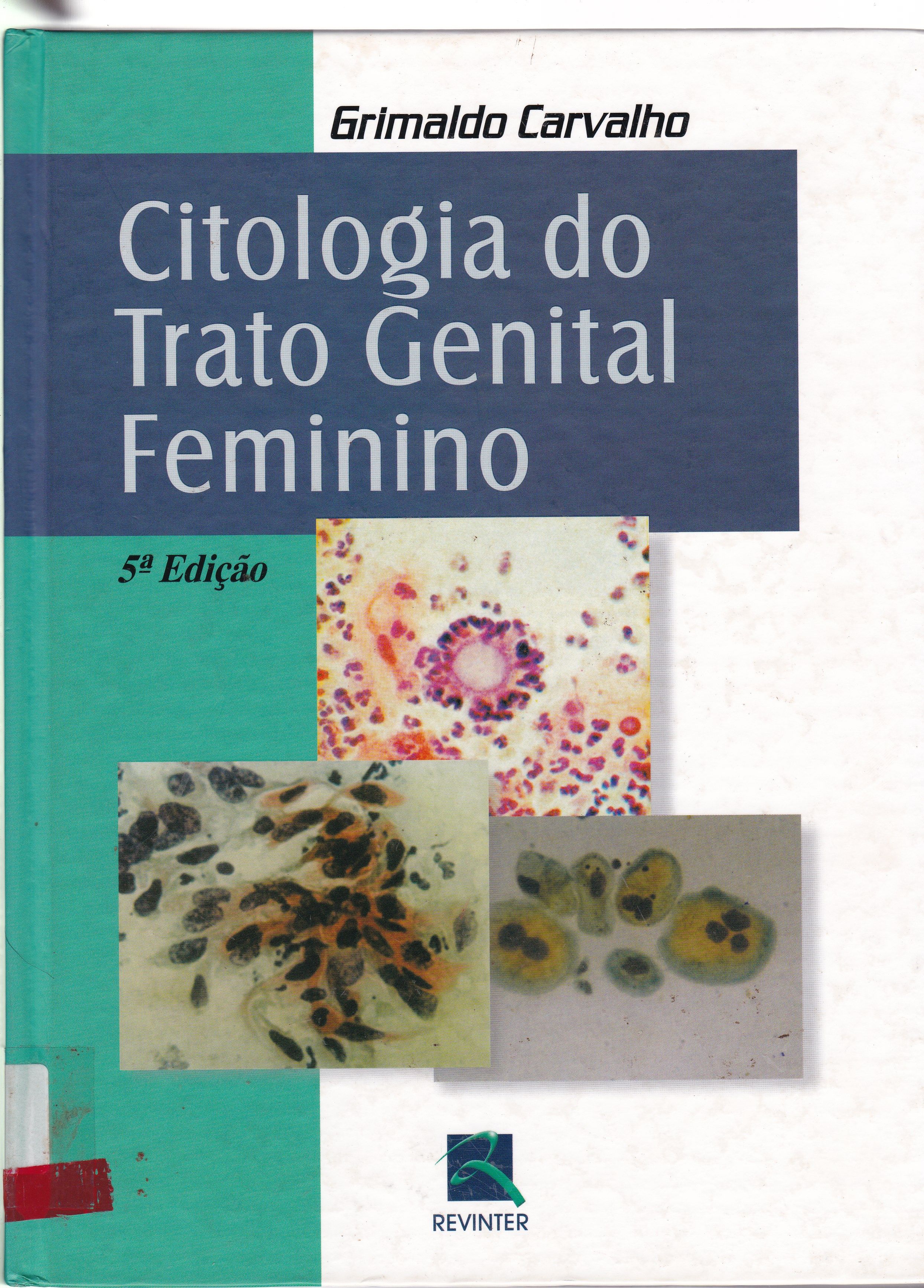 CITOLOGIA DO TRATO GENITAL FEMININO