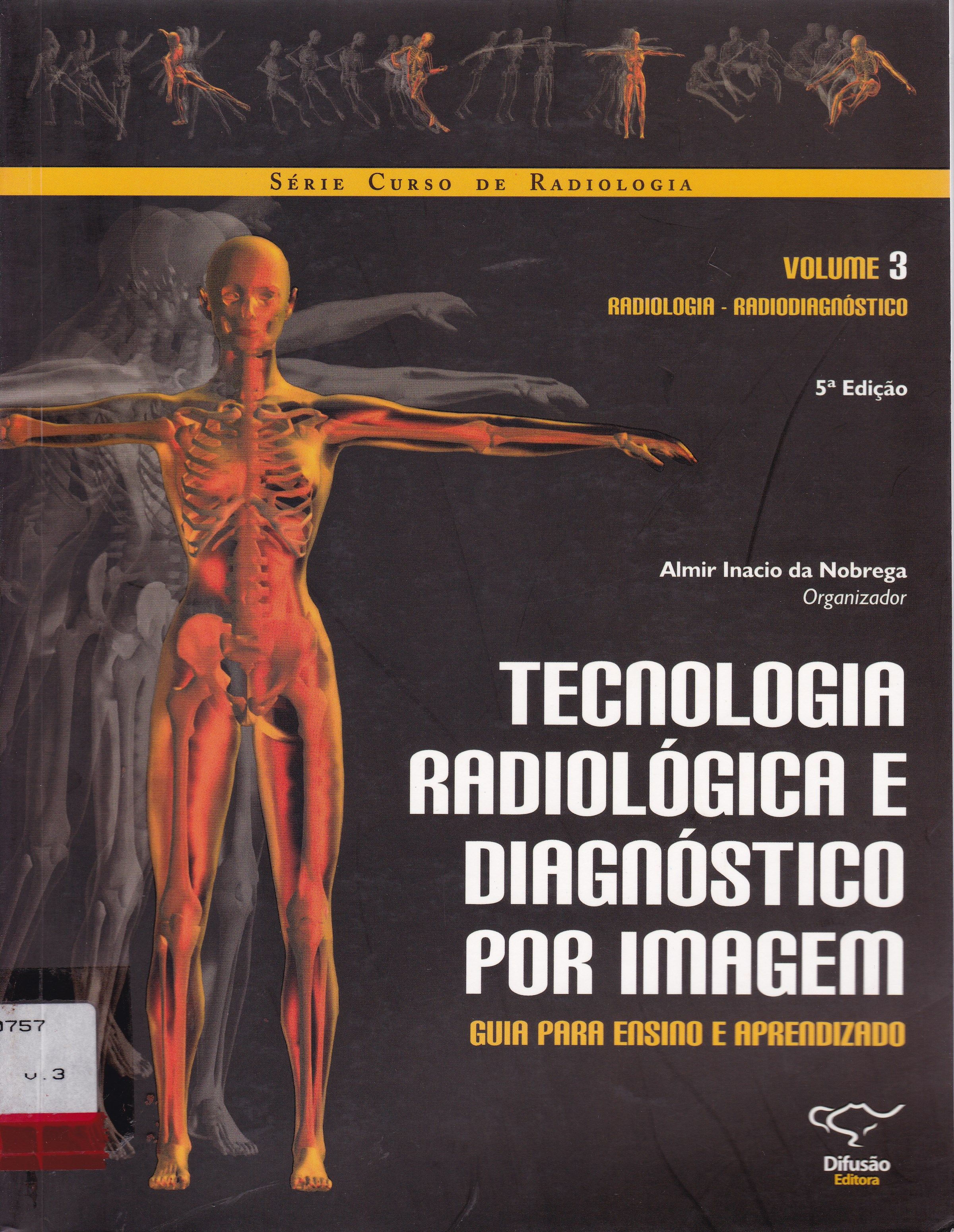 TECNOLOGIA RADIOLÓGICA E DIAGNÓSTICO POR IMAGEM : GUIA PARA ENSINO E APRENDIZADO : RADIOLOGIA RADIODIAGNÓSTICO V. 3