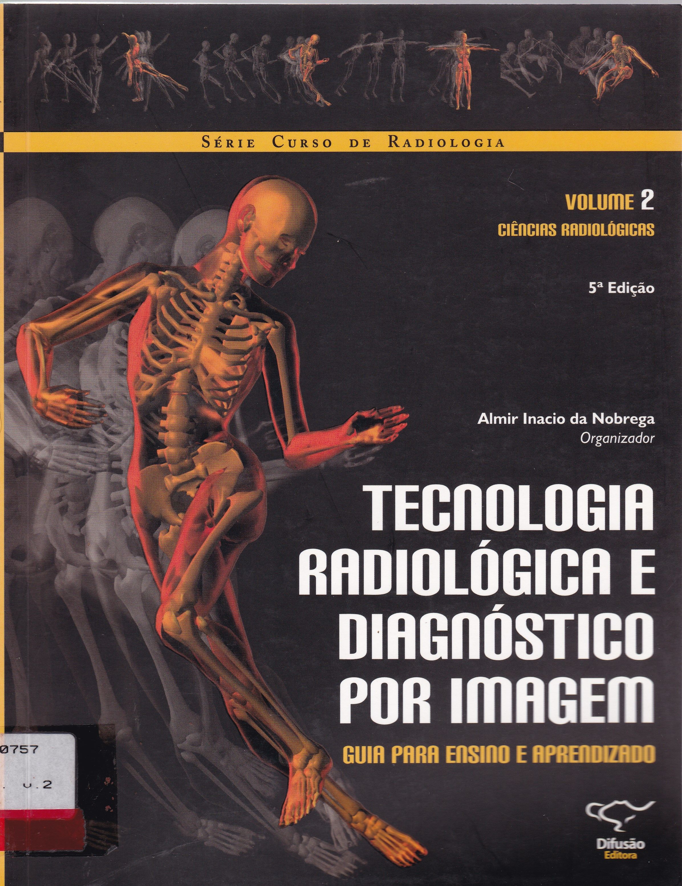 TECNOLOGIA RADIOLÓGICA E DIAGNÓSTICO POR IMAGEM : GUIA PARA ENSINO E APRENDIZADO : CIÊNCIAS RADIOLÓGICAS V. 2