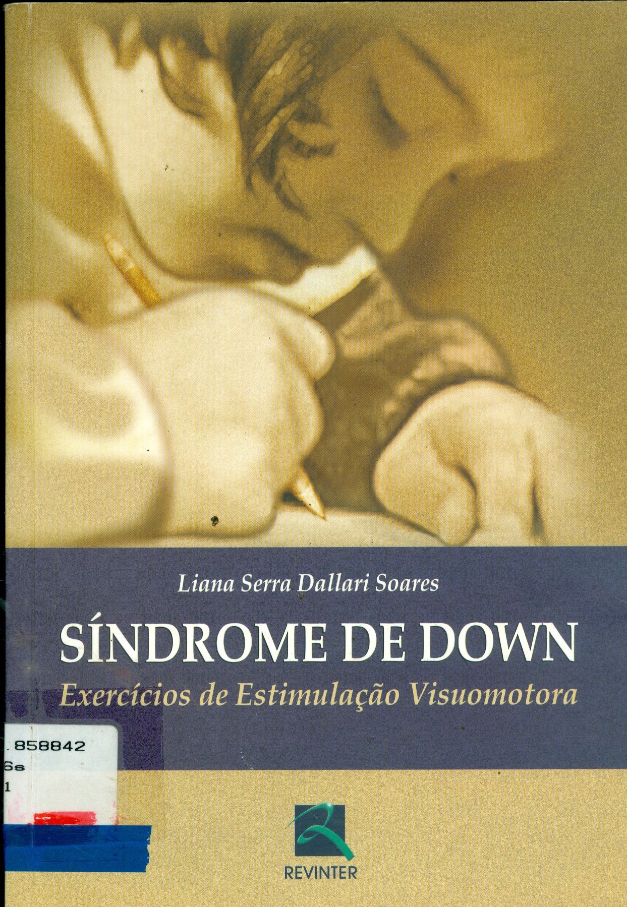 SÍNDROME DE DOWN: EXERCÍCIOS DE ESTIMULAÇÃO VISUOMOTORA