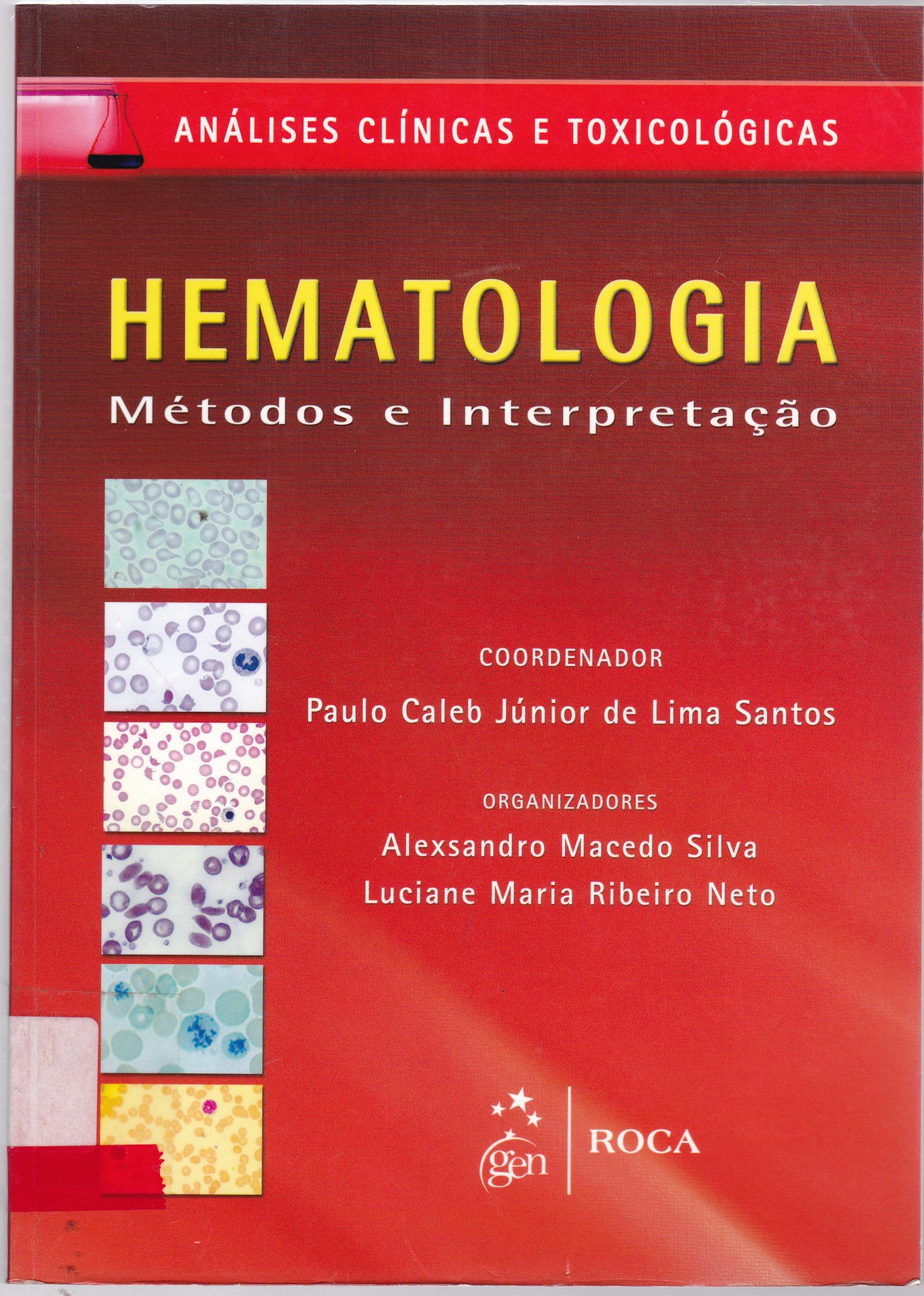 HEMATOLOGIA: MÉTODOS E INTERPRETAÇÃO