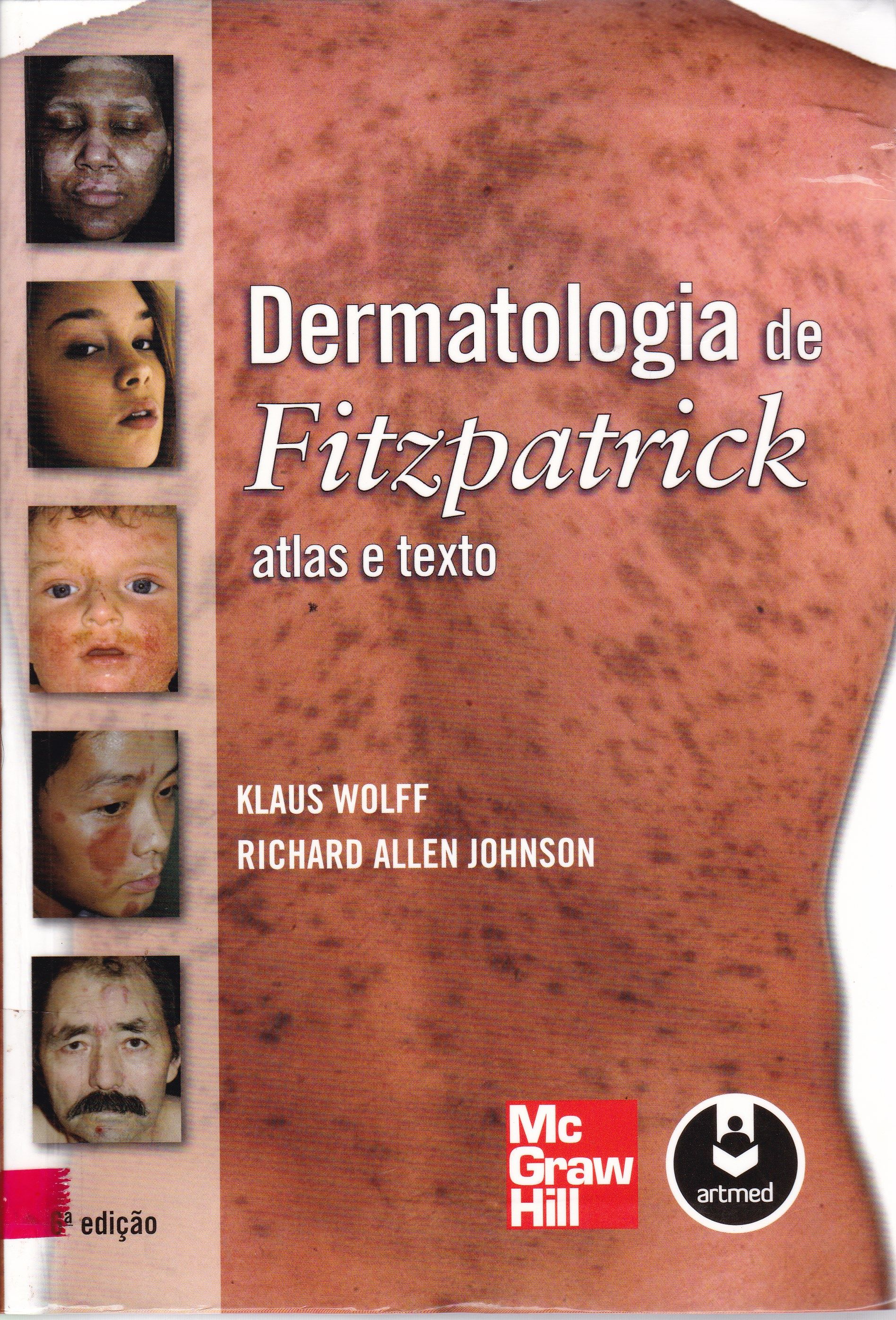 DERMATOLOGIA DE FITZPATRICK: ATLAS E TEXTO