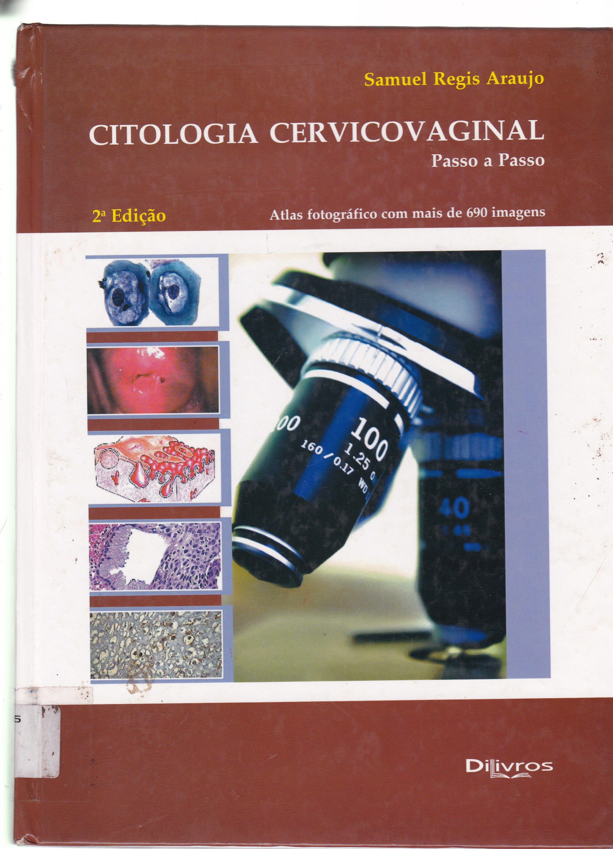 CITOLOGIA CERVICOVAGINAL: PASSO A PASSO