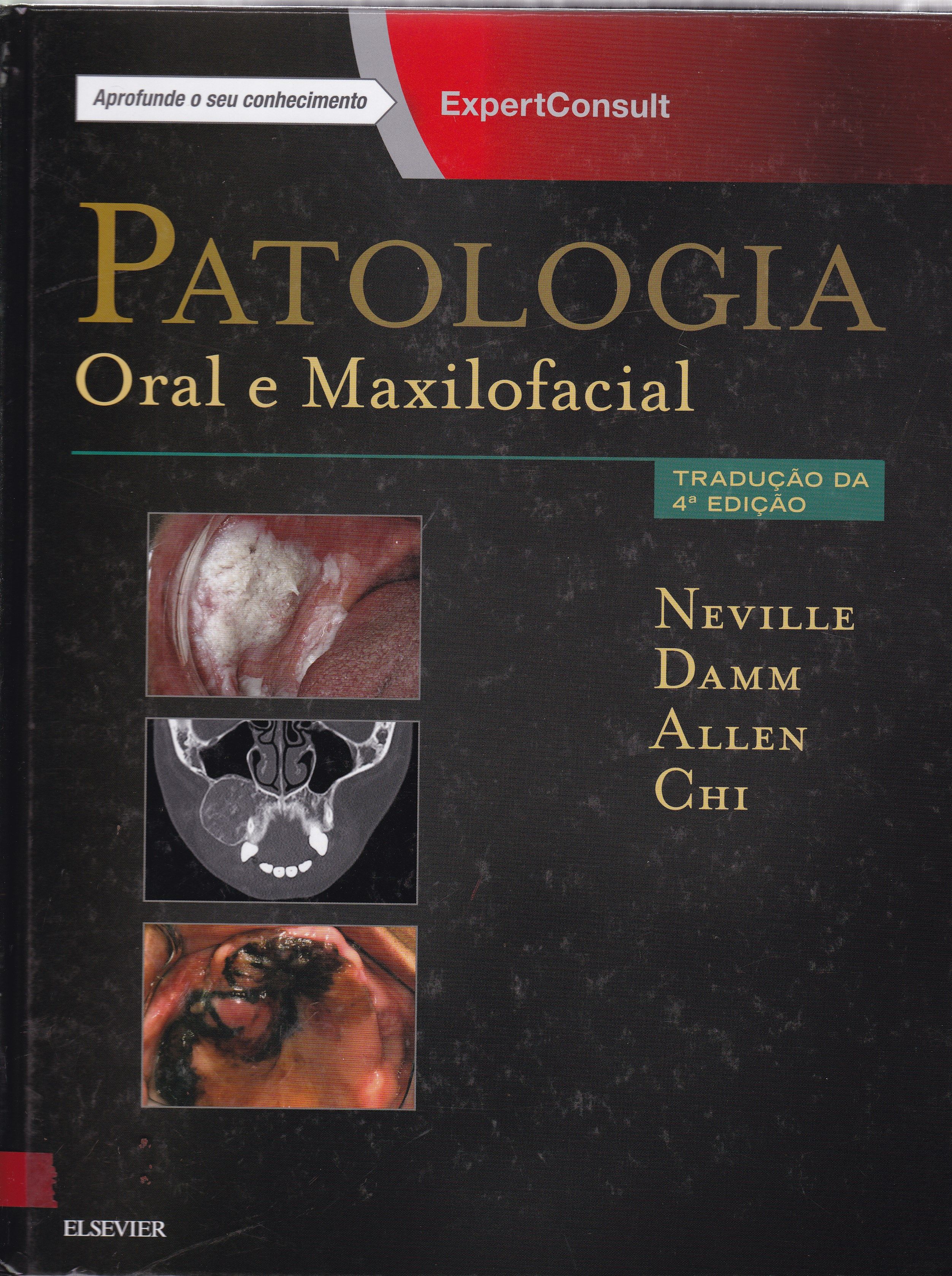 PATOLOGIA ORAL E MAXILOFACIAL