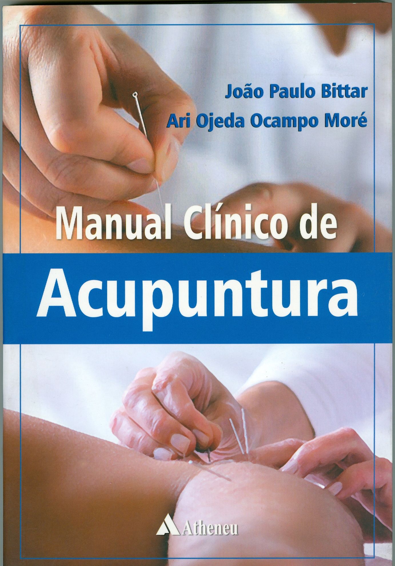 MANUAL CLÍNICO DE ACUPUNTURA