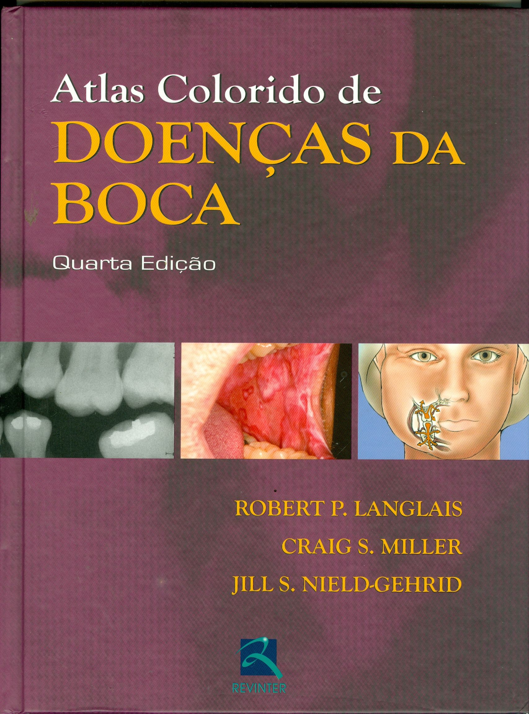 ATLAS COLORIDO DE DOENÇAS DA BOCA