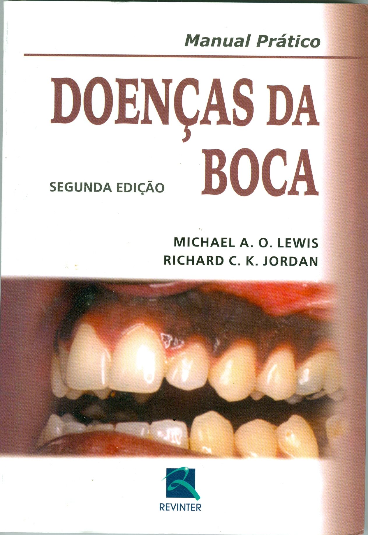 DOENÇAS DA BOCA