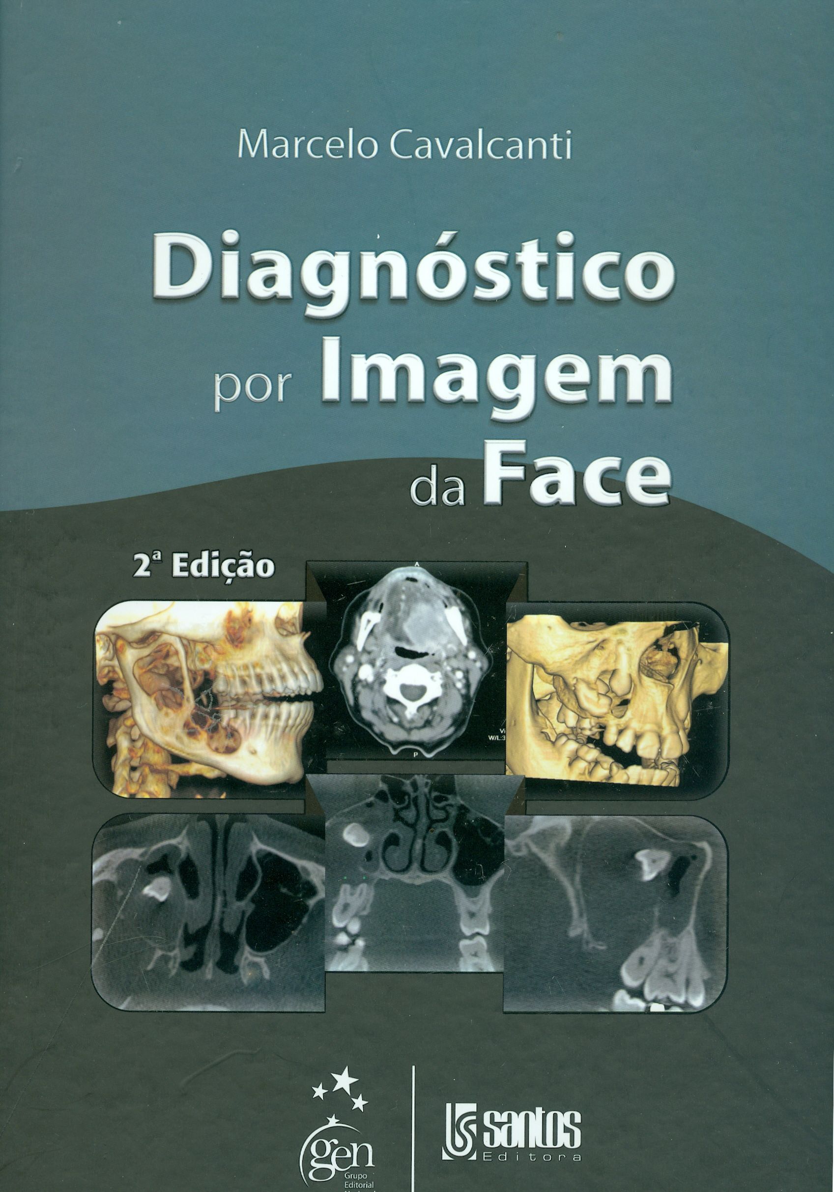 DIAGNÓSTICO POR IMAGEM DA FACE