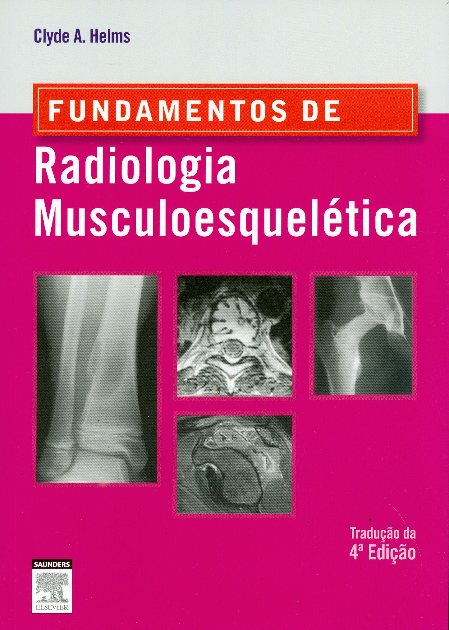 FUNDAMENTOS DE RADIOLOGIA MUSCULOESQUELÉTICA