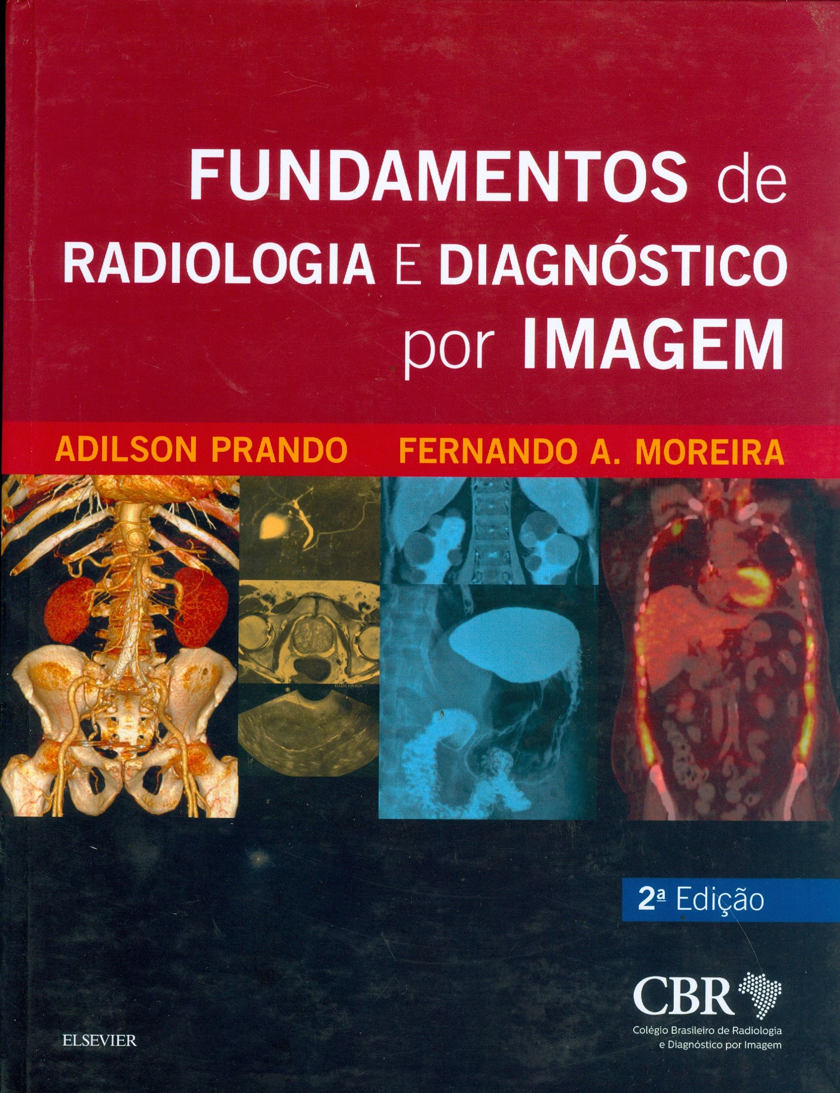 FUNDAMENTOS DE RADIOLOGIA E DIAGNÓSTICO POR IMAGEM