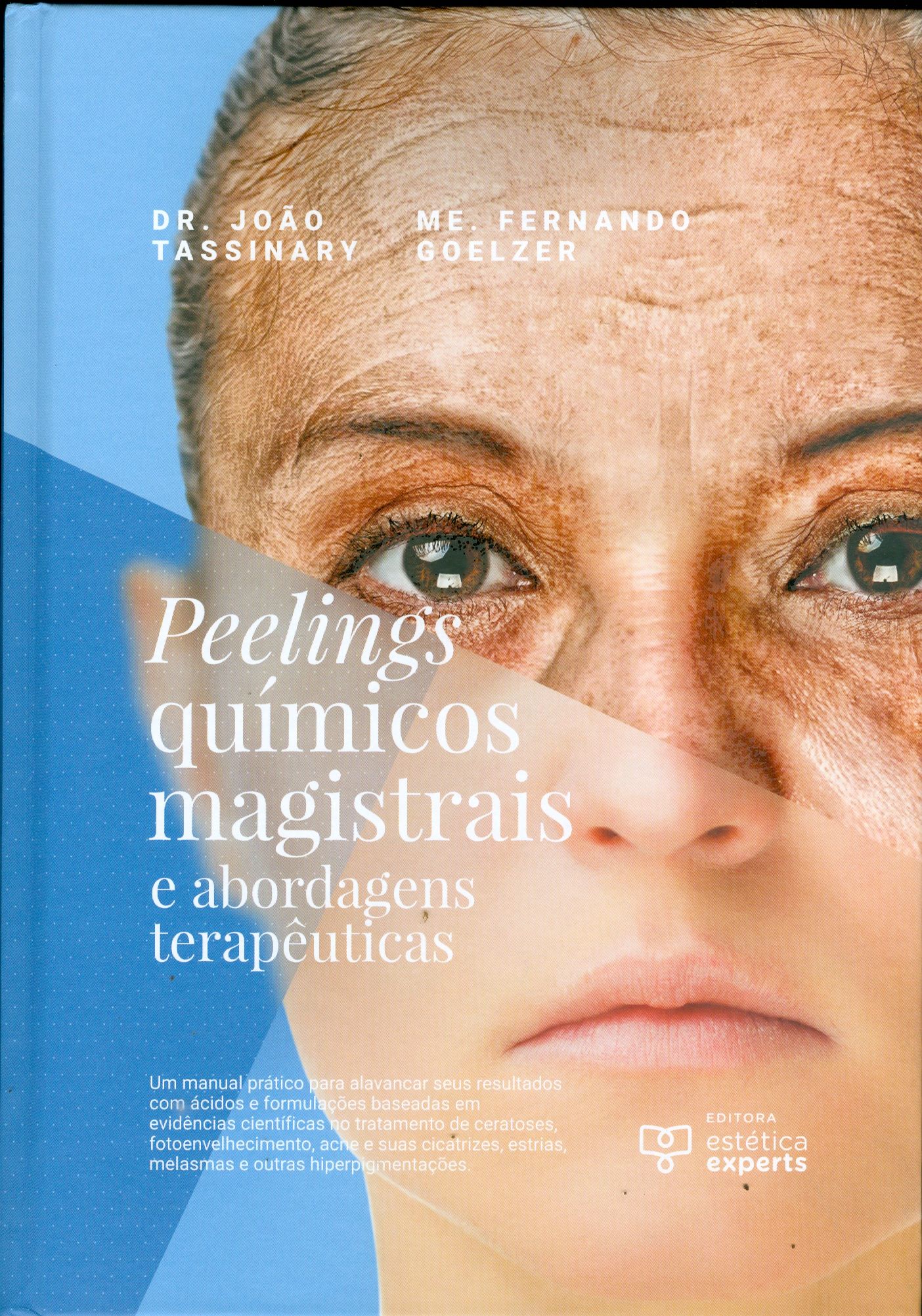 PEELINGS QUÍMICOS MAGISTRAIS