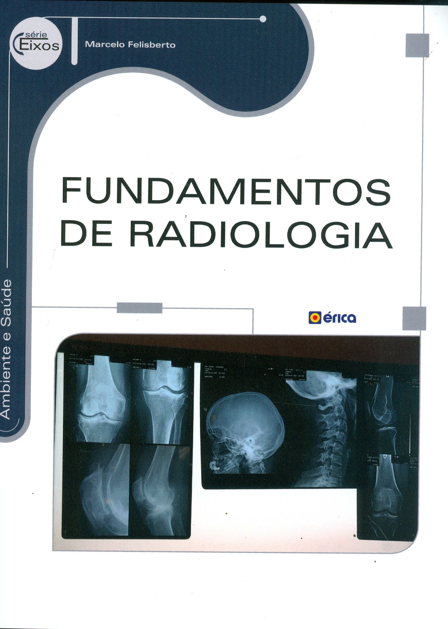 FUNDAMENTOS DA RADIOLOGIA