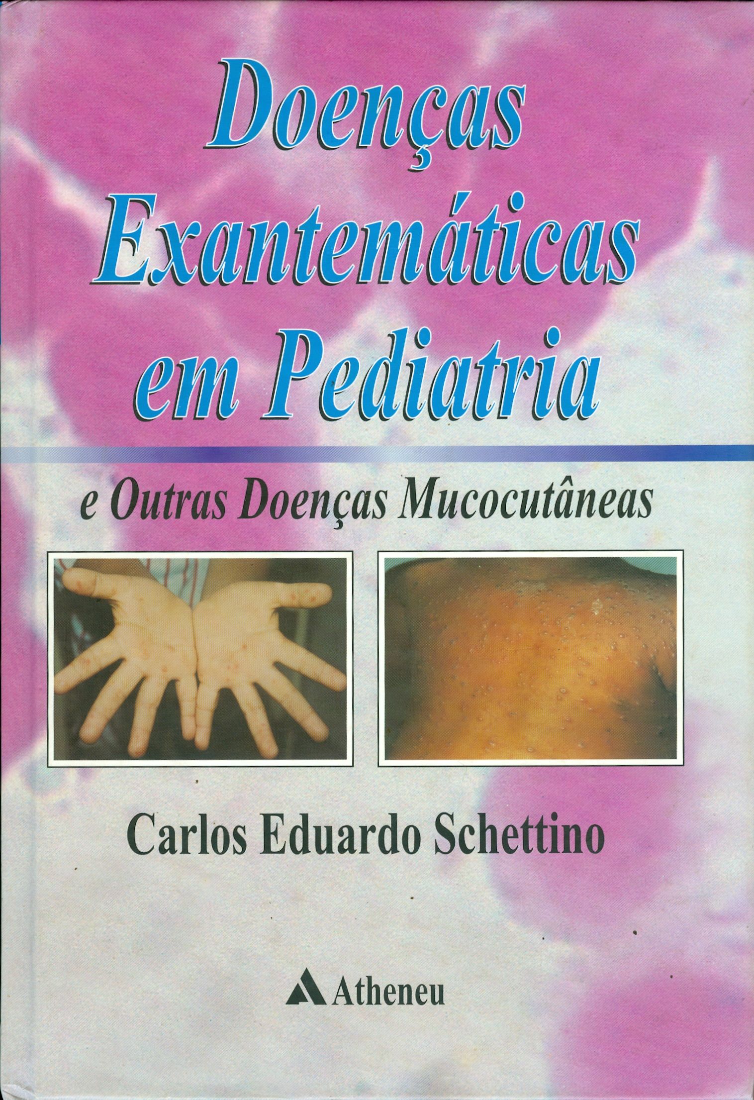 DOENÇAS EXANTEMÁTICAS EM PEDIATRIA E OUTRAS DOENÇAS MUCOCUTÂNEAS