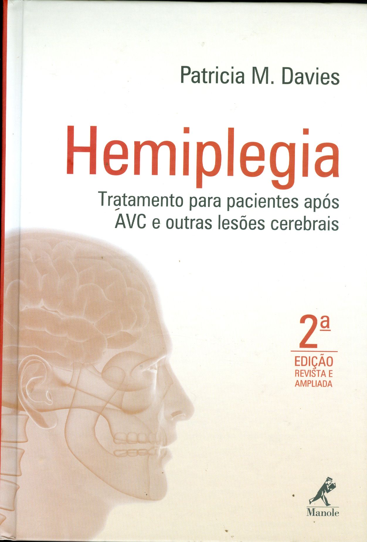 HEMIPLEGIA: